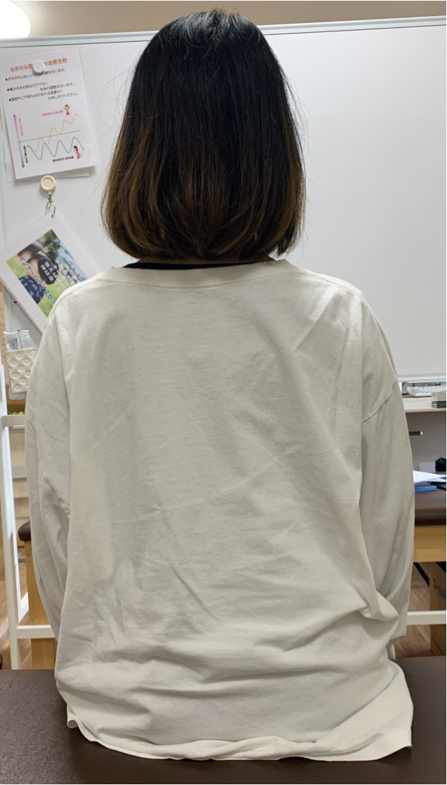 before画像